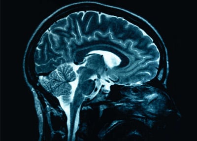admirable_design_brain.jpg
